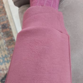 Kısa Sürede Tüylenen Eşofman Ve Destek Eksikliği