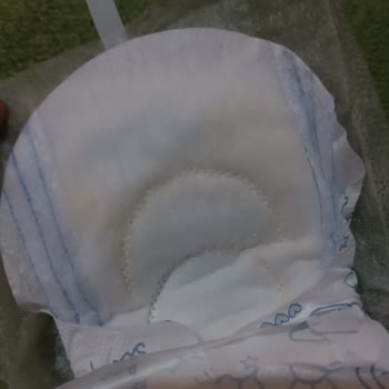 Molped Supernight Mega Pedinde Belirsiz Lekeler Hijyen Endişesi