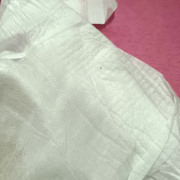 Molfix Bebek Bezinde Kalite Sorunu Tekrarlandı, İade Talebi