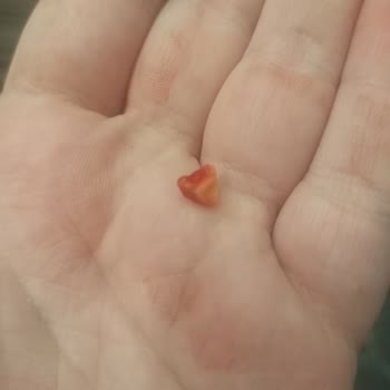 Kahve Dünyası Çikolatasında Taş Benzeri Yabancı Madde Ve Sağlık Riski