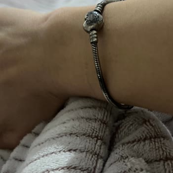 Pandora Bileklik Ve Charm’ların Kararması, Garanti İhmali