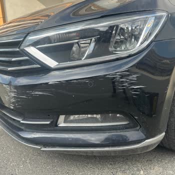 Ümraniye Belediyesi Çöp Personelinin Araç Hasarı Ve Kasıtlı Tehdidi