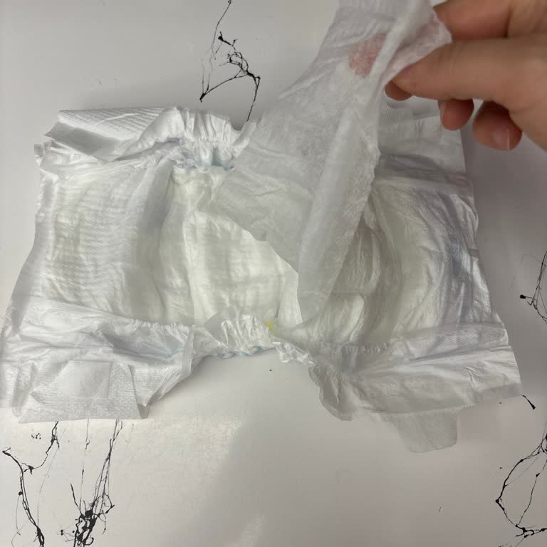 Molfix 5 Numaralı Bebek Bezinde Yabancı Madde Çocuğumda Sürekli Pişik