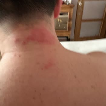 Tahta Kurusu Dolu Refakatçi Yatağı, İhmal Edilen Hijyen Ve Geciken Yemek Hizmeti