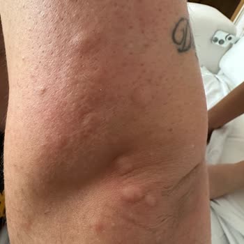 Tahta Kurusu Dolu Refakatçi Yatağı, İhmal Edilen Hijyen Ve Geciken Yemek Hizmeti