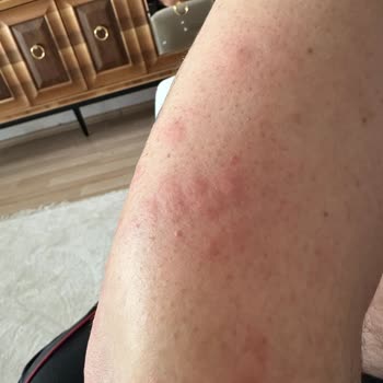 Tahta Kurusu Dolu Refakatçi Yatağı, İhmal Edilen Hijyen Ve Geciken Yemek Hizmeti