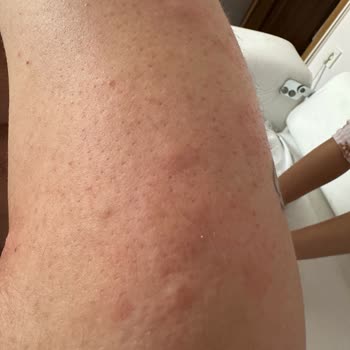 Tahta Kurusu Dolu Refakatçi Yatağı, İhmal Edilen Hijyen Ve Geciken Yemek Hizmeti