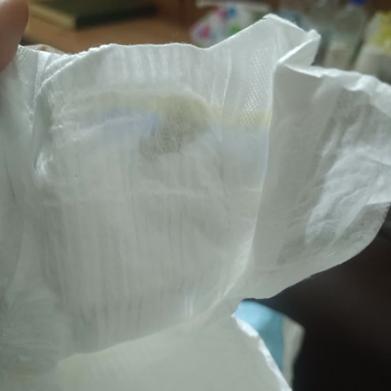 Molfix Yenidoğan Bezinde Sert Parça: Çocuk Güvenliği Tehlikede