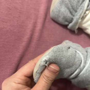 Ayıplı Çocuk Pandufu Deforme Olup Yırtıldı Ve Ayakları Terletiyor