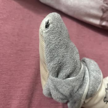 Ayıplı Çocuk Pandufu Deforme Olup Yırtıldı Ve Ayakları Terletiyor