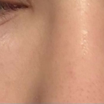 Prof. Dr. Ömer Karakoç Yaklaşık İki Hafta Süren Yoğun Bir Morluk Oluştu