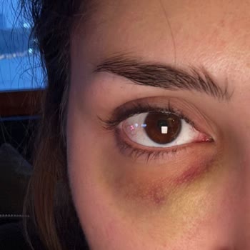 Prof. Dr. Ömer Karakoç Yaklaşık İki Hafta Süren Yoğun Bir Morluk Oluştu