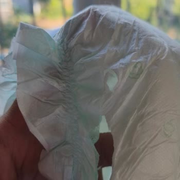 Bim'den Alınan Jenny&Willy Bebek Bezlerinde Sürekli Yırtık Sorunu