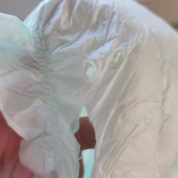 Bim'den Alınan Jenny&Willy Bebek Bezlerinde Sürekli Yırtık Sorunu