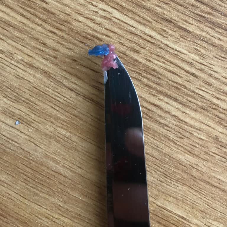 A101 Afyon Şubesinde Kıymada Plastik Parça Ve Gıda Güvenliği Endişesi