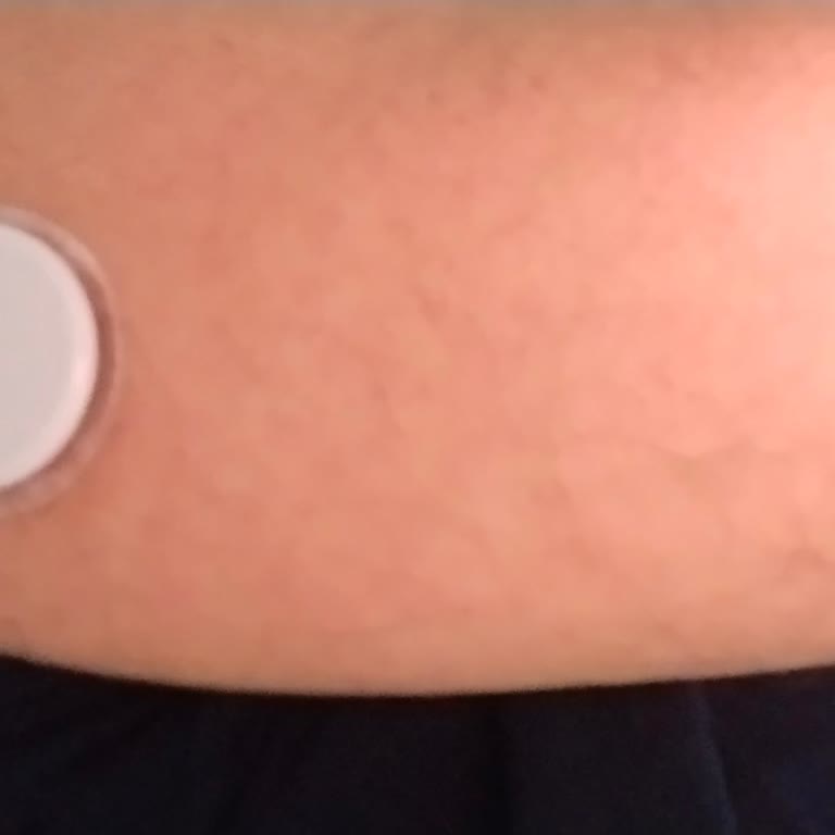 Mi sensor FreeStyle Libre 2 pierde conexión constantemente