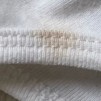 Profilo Çamaşır Makinesinde Leke Sorunu Ve Servis İletişimsizliği