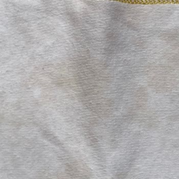 Profilo Çamaşır Makinesinde Leke Sorunu Ve Servis İletişimsizliği