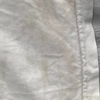 Profilo Çamaşır Makinesinde Leke Sorunu Ve Servis İletişimsizliği