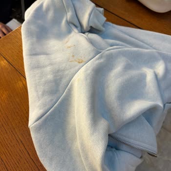 Mola İstanbul'da Pas Lekesi Ve Hizmet Sorumsuzluğu