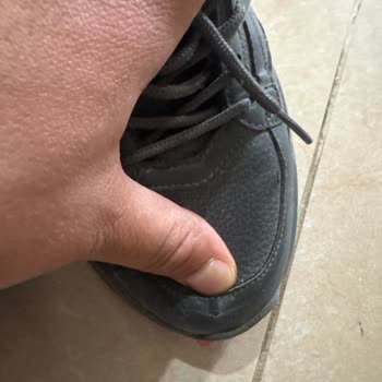 Açılan Burun, Renk Solması Ve Deformasyon: Üç Teste Rağmen Çözüm Yok