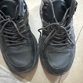 Açılan Burun, Renk Solması Ve Deformasyon: Üç Teste Rağmen Çözüm Yok