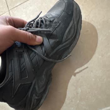 Açılan Burun, Renk Solması Ve Deformasyon: Üç Teste Rağmen Çözüm Yok