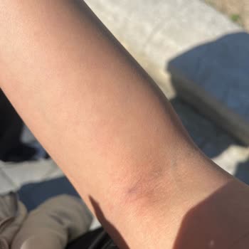 Kan Alma İşleminde Kaba Ve Saygısız Davranış