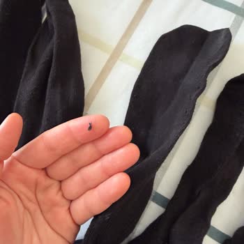 İlk Yıkamada Aşırı Tüylenen Çorap Kalite Şüphesiyle Değişim Talebi