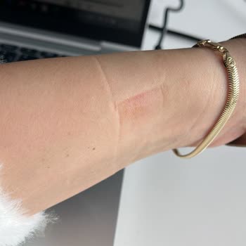 Terle Temas Eden Huawei Watch Fit’in Paslanması Garanti Kapsamında Değerlendirilsin