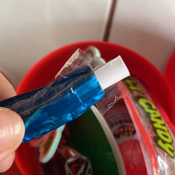 Orka Oyuncak Sürpriz Yumurtası Çocuğun Dudağını Yaraladı