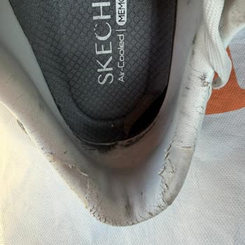 Skechers Ayakkabımda Erken Aşınma Ve Garanti Reddi
