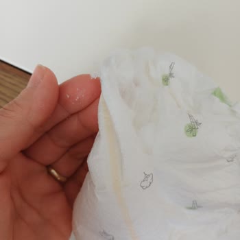 Sleepy Bebek Bezinde Sert Partiküller Ve Sürekli Sızdırma