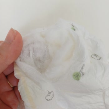 Sleepy Bebek Bezinde Sert Partiküller Ve Sürekli Sızdırma