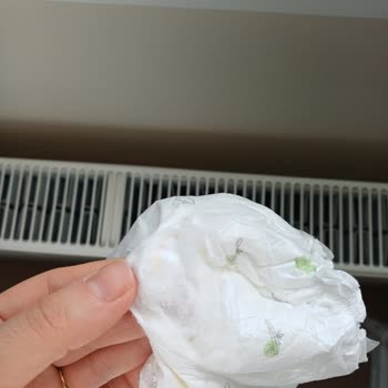 Sleepy Bebek Bezinde Sert Partiküller Ve Sürekli Sızdırma