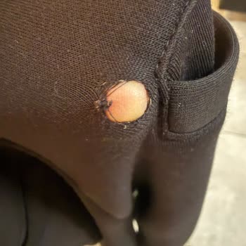 Armani Pantolonun İlk Kullanımda Delinmesi Ve Çetin Family'nin Sorumluluk Reddi