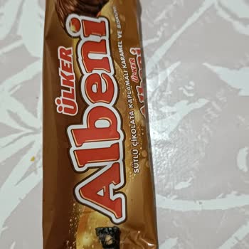 Ülker Albeni Çikolatasından Çıkan Metal Parça Dişimi Kırdı