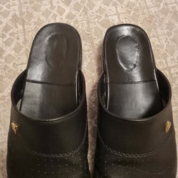 Jelli Tabanlı Terlikte Jel Sızıntısı Ve Müşteri Hizmetlerinin Çözüm Bulamaması