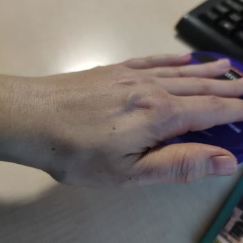 Neutrogena El Kremi Kullanırken Siyahlaşma Ve Yapışkan Tabaka Sorunu