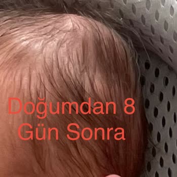 Bebekte Şişlik Ve Olası Kırık, Hastane Açıklama Yapmadı