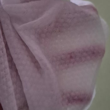 Eruslu Havlusunda İncelme Ve Kalınlık Azalışı Tüketiciyi Aldattı