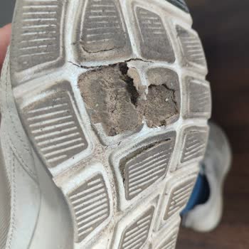 Skechers Günlük Spor Ayakkabısının Tabanı Dört Ayda Deforme Oldu