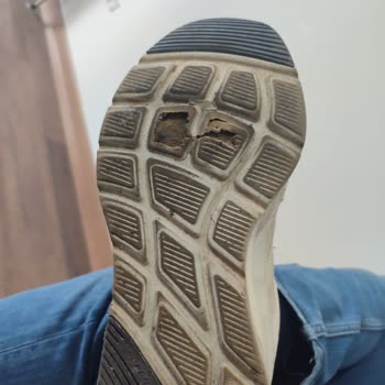 Skechers Günlük Spor Ayakkabısının Tabanı Dört Ayda Deforme Oldu