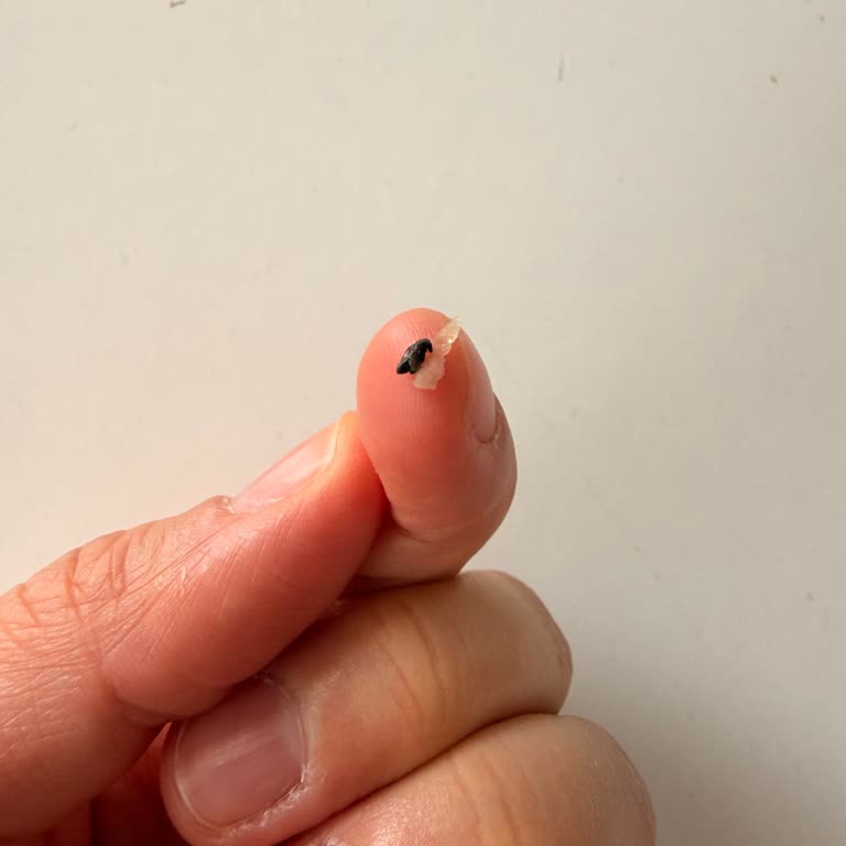 Böcekli Rüşeym Ve Yeşil Mercimekte Hijyen İhlali Ve Tam İade Talebi