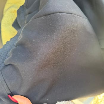 Tek Kullanımdaki Eşofmanda Görülen Kumaş Deformasyonu İçin Mağaza Çözüm Sunmuyor