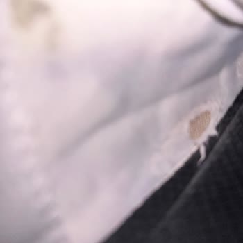 Skechers D’Lites 4.0 Model Ayakkabısında Erken Deformasyon Ve Cevapsız Şikayet