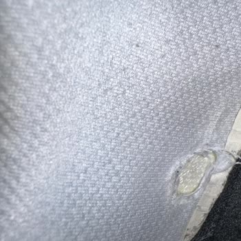 Skechers D’Lites 4.0 Model Ayakkabısında Erken Deformasyon Ve Cevapsız Şikayet