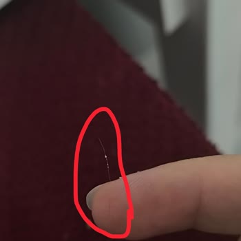 Cornetto Dondurmasında Kıl Çıktı Hijyen Sorunu