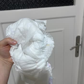 Molfix Bebek Bezi Katmanının Açılması Ve Sızdırma Sorunu