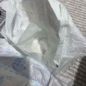 Molfix Bebek Bezi Katmanının Açılması Ve Sızdırma Sorunu